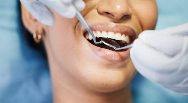 Best Emergency Tooth Extraction in Mount Carroll, IL
